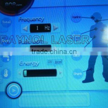 Immediately Depilation Beauty Equipment Manufacture Permanent Hair Remover 808nm Diode Laser photo-4