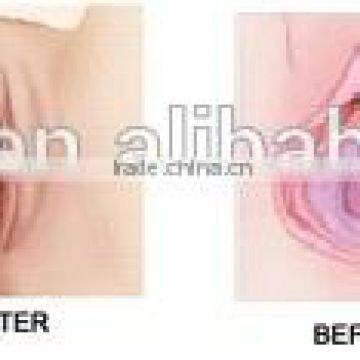 Eye Wrinkle / Bag Removal Popular Model F7+ Vaginal Fractional Rf Skin Resurfacing Co2 Fractional Laser Vaginal Tighten Machine photo-6