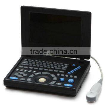 2015 New Laptop Ultrasound Scanner (PC System) on Sale photo-2
