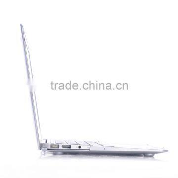 for Macbook Metal Hard Case Beautiful Colors Laptop Cases for Girls photo-4