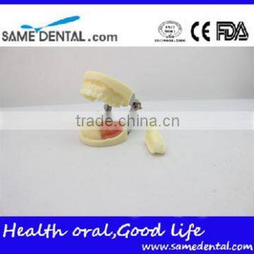 Dental Implant Practice Model DEA-31 Teeth Implant Models