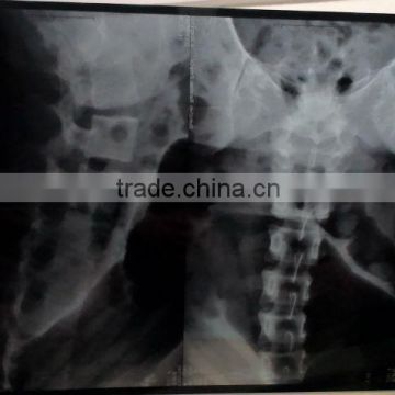 China medical thermal CT MRI DR CR DSA film CE KND film