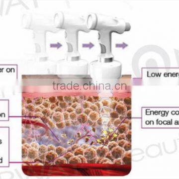 Beauty & Personal Care Best Liposonic Body Slimming Machine HIFU for Whole Body Sculpting Treatment photo-2