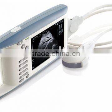 Ultrasound scanner