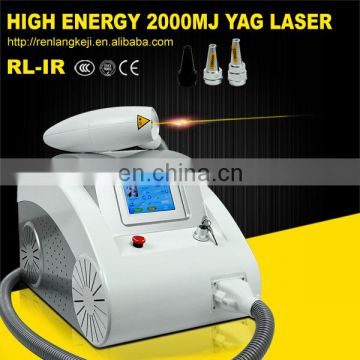 New laser tatoo removal/q switch laser for tattoo removal machine