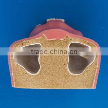 Factory Price Clinical Drill Model Cableway/ Dental Implant Model/implantes for Teeth photo-4