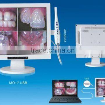 17" Monitor with Built in Intraoral Camera wired/wireless