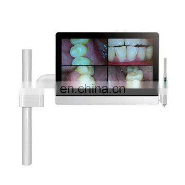 MY-M069C medical intraoral camera all in one best dental intraoral camera with stand,keyboard,mouse