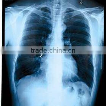 medical film x-ray dry film thermal film dry imaging film digital blue films konica medical film