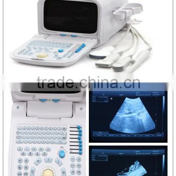 type-B ultrasonic Ultrasound Scanner multi-frequency probe convex micro-convex linear transvaginal rectal