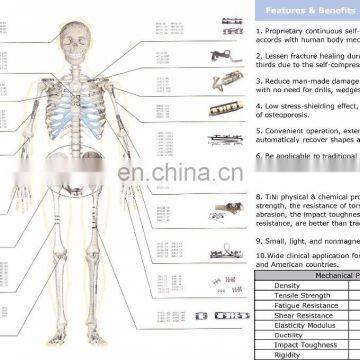Bone Clasp With Rivet Teeth Ring Shaped TiNi SMA Fixater photo-6
