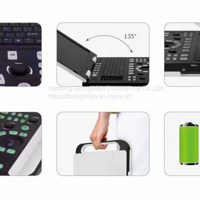 Notebook Ultrasound Scanner Detector for Human Pregnancy Checking photo-2