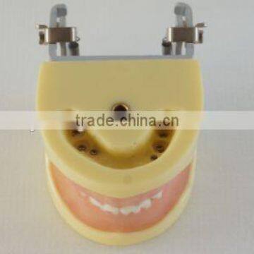 Pediatrics Typodont Teeth Model (20 Teeth) With Removable Screw Teeth photo-3