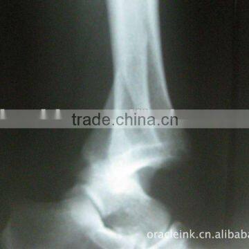 Radiographic medical x ray film, compatible agfa cr