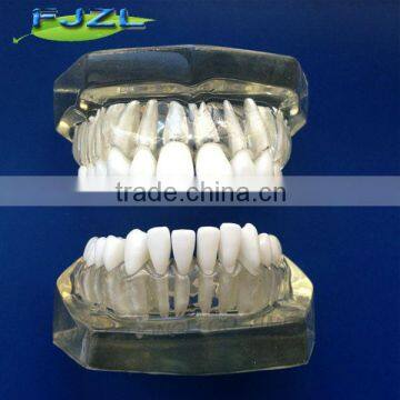 Dental Tooth Extraction Training Model