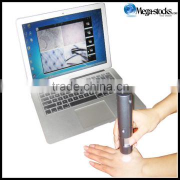 New 5.0 MP USB Skin Analyzer Skin Diagnosis Camera & Automatic English Software