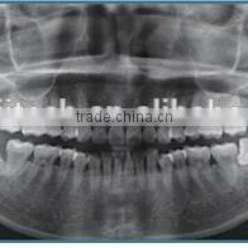China Cheap Dental Panoramic and Cephalometric X-ray Machine photo-5