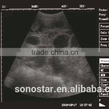 Sonostar Portable Cow Ultrasound Machine Pig Pregnancy Ultrasound Scanner Pirce V5 photo-6