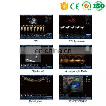 MY-A039A Color Doppler Ultrasound Price Portable Ultrasound Machine photo-6