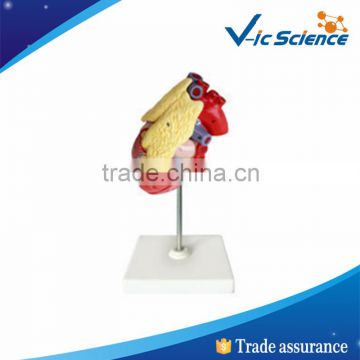 High quality medical heart with thymus model