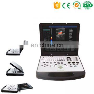 MY-A024A Medical 3D Color Doppler Ultrasound Machine Portable PC Ultrasound Scanner for SALE