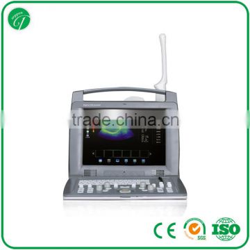 Diagnostic ultrasound equipment 3D/4D laptop portable color doppler ultrasound scanner