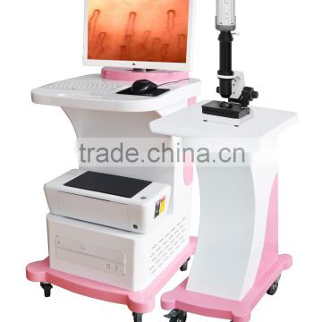 popular new Microcirculation Analyzer System 100 to 650 times magnification