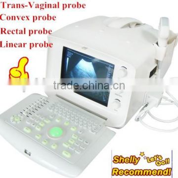 RUS-6000A Best Sale Hospital Clinic Portable Ultrasound Machine/Scanner with convex, transvaginal, linear, rectal probe-Shelly