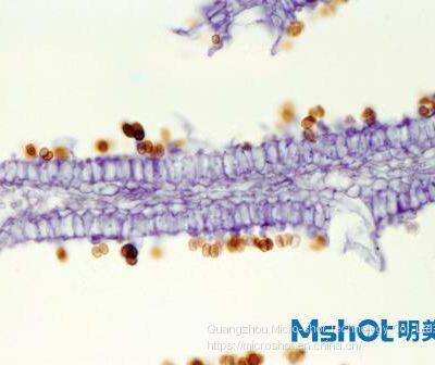 Routine Biological Microscope With Trinocular Observation Tube ML31 photo-2