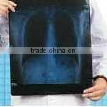 x ray film china, fuji x ray film of equipment accessories