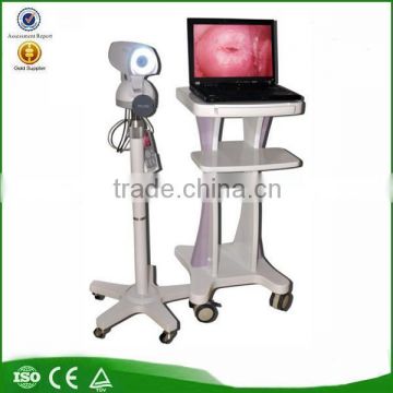 Medical Equipment Portable Digital Camera Vaginoscope Colposcope