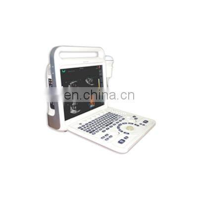 Superior 15 inch full digital color doppler system for hospital use