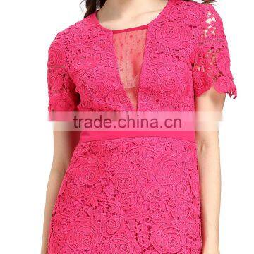 Fashion Lace Patchwork Short Frock Lady Image Skater Dress photo-2