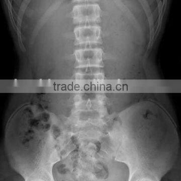 news product ,ct scan film for medical equipment  china