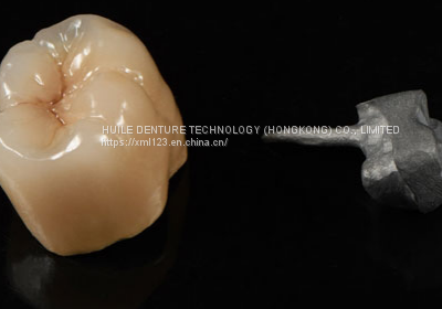 Metal Crown/bridge Chinese Denture Manufacturer photo-4