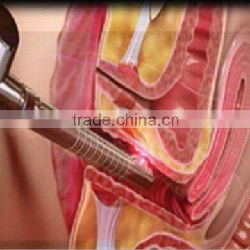 CO2 Laser Beauty Device for Vaginal Tightening&vaginal Nourish With High Quality photo-5