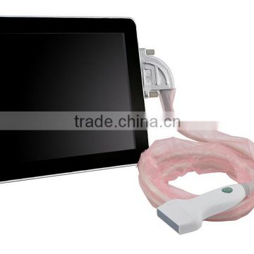 9.7 inch Touchscreen Full Digital UpadScan Ultrasound Scanner with CE approved