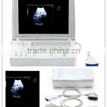 15-inch Laptop Ultrasound Scanner with Multi-frequency probes