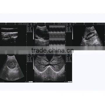 China Beijing 10.7 Inch Color LCD 2B Ultrasound Imaging System Laptop Ultrasound Scanner With CE ISO Approved photo-3