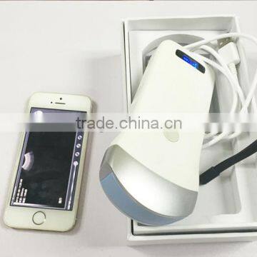 Wireless Convex Probe Scanner, WiFi, Used in Surgery Without Fixing of Cables, 3.5MHz / R40 / 64 Elements, SIFULTRAS-5.1 photo-5