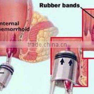 Silicone Hemorrhoid O-Bands (100% Latex-Free)