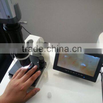 Nailfold capillaroscopy microcirculation detector body analyzer machine price
