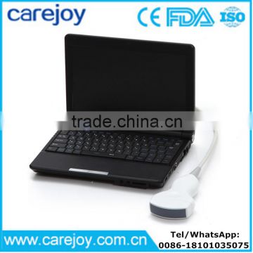 Carejoy Laptop Ultrasound Scanner / machine with 3.5Mhz convex probe by CE ISO approved