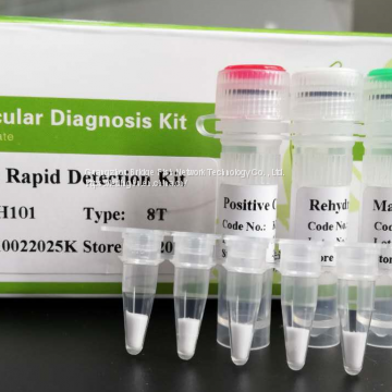 Novel Coronavirus (COVID-19) Nucleic Acid Detection Kit