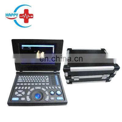 HC-A007 Factory Direct Medical Laptop portable Ultrasound scanner system ultrasound machine