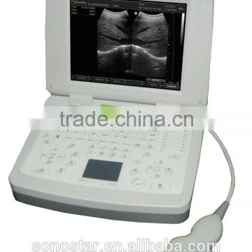 SS-9 PC Based Laptop Ultrasound B scanner