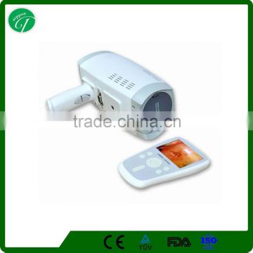 gynaecology diagnostic equipment/vagina examination/ Portable endoscope medical camera