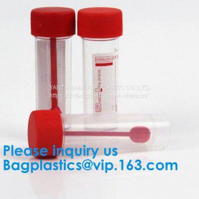 Disposable Urine Specimen Cup/Urine Sample Containers/Urine Collection Cup,Sterile Disposable Hospital Sample 60ml 100 photo-3