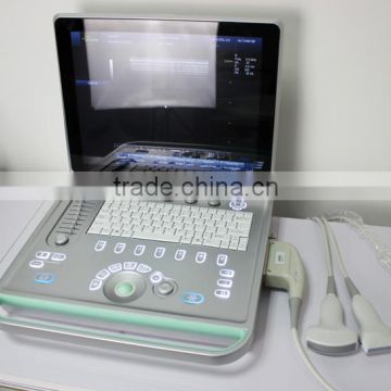 Pretty Laptop Color Doppler Ultrasound System