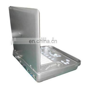15 Inch 2D/3D B/W Laptop Digital Portable Ultrasound Units photo-2